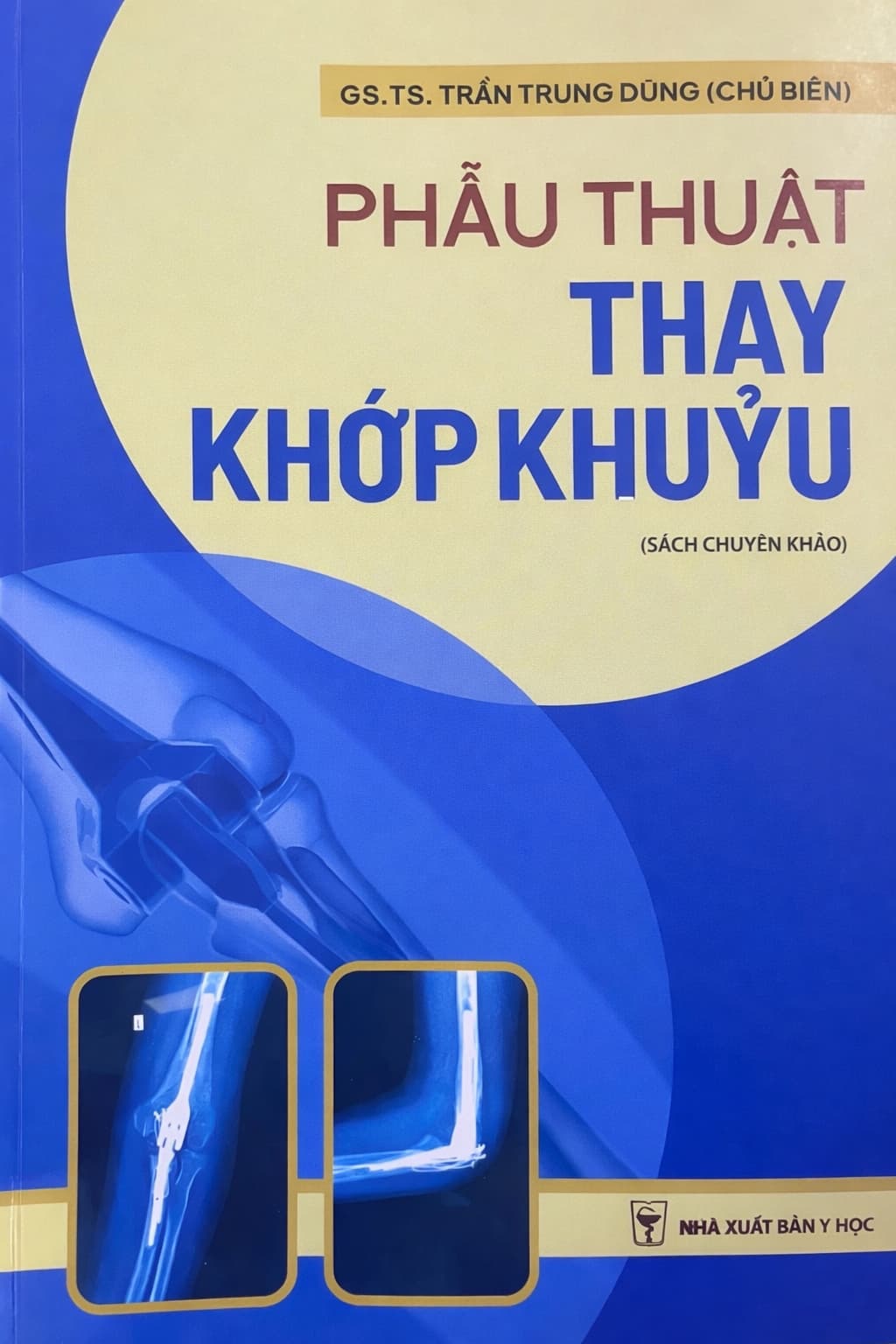 Phẫu thuật thay khớp khuỷu PDF