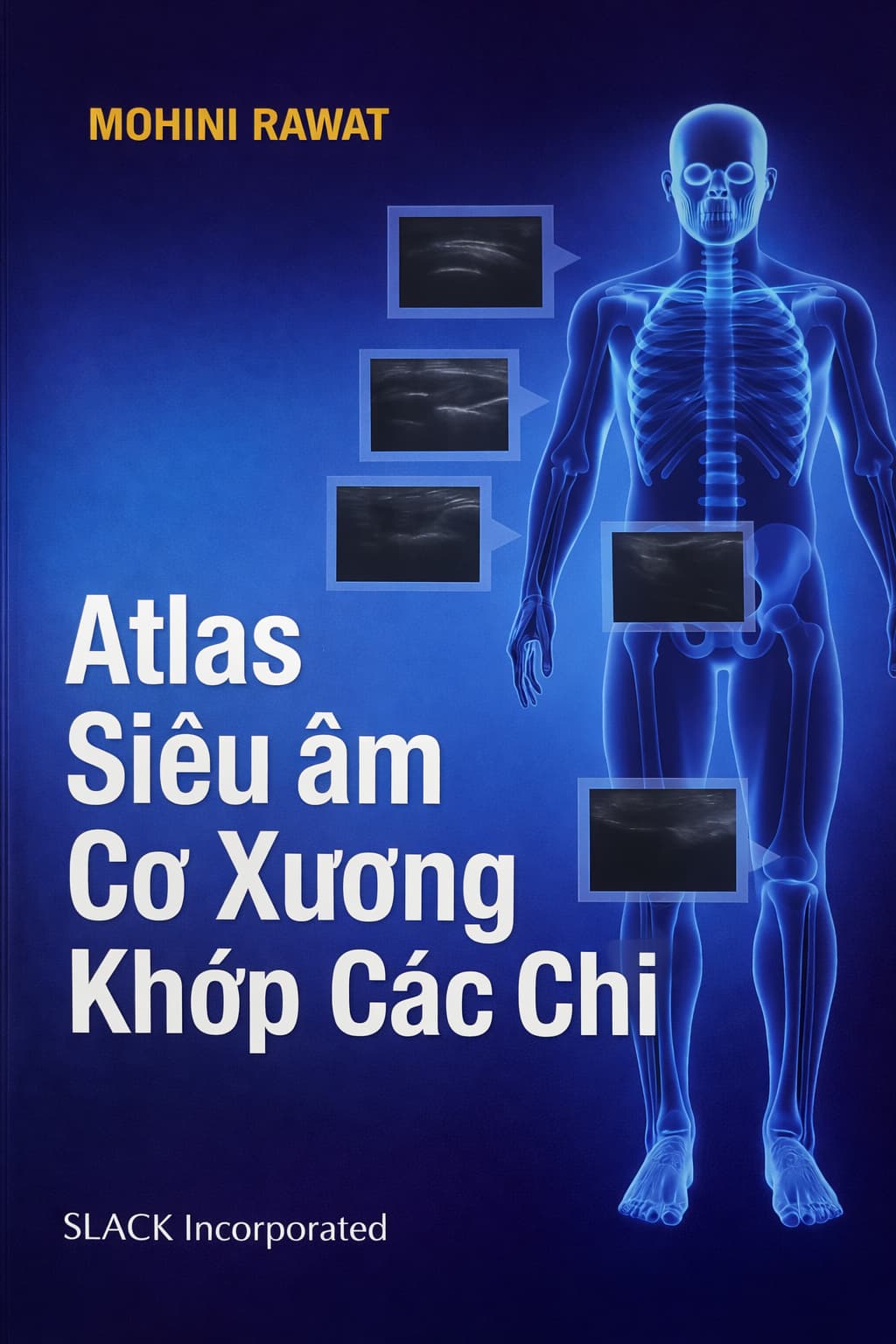 Atlas siêu âm cơ xương khớp các chi PDF