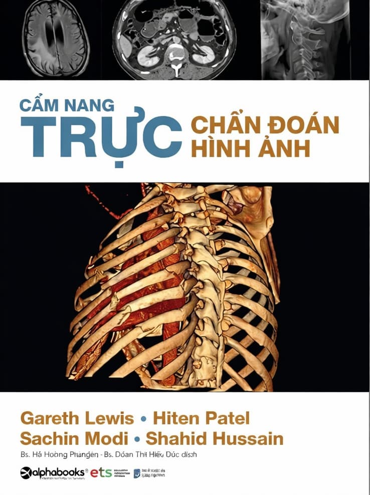 CẨM NANG TRỰC CHẨN ĐOÁN HÌNH ẢNH PDF