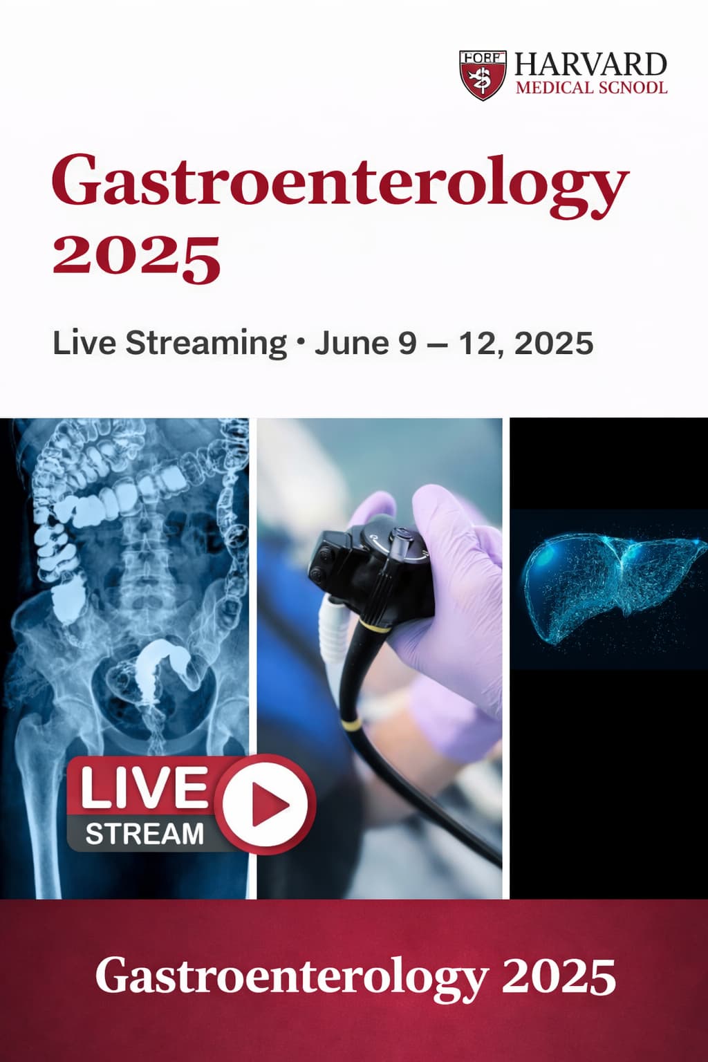 Harvard Gastroenterology 2025 (Phụ đề song ngữ)
