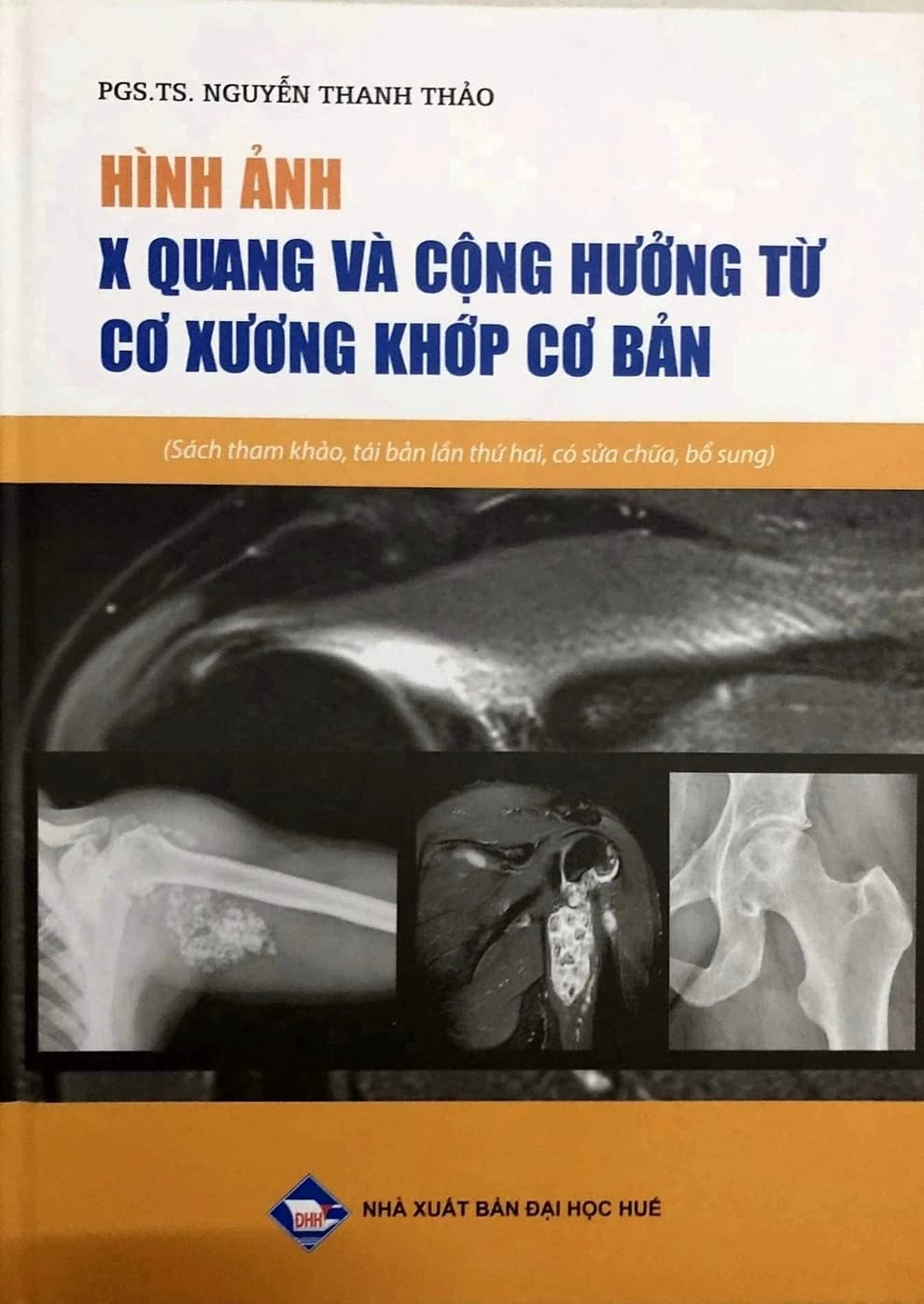 Hình ảnh X-quang và Cộng hưởng từ Cơ Xương Khớp Cơ bản PDF