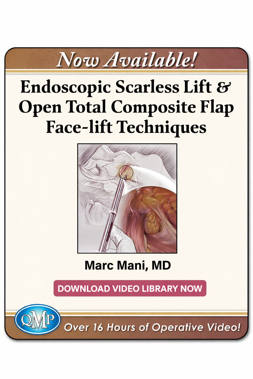 Nâng mặt lớp phức hợp nâng cao: kỹ thuật nội soi và mổ mở (Phụ đề song ngữ)