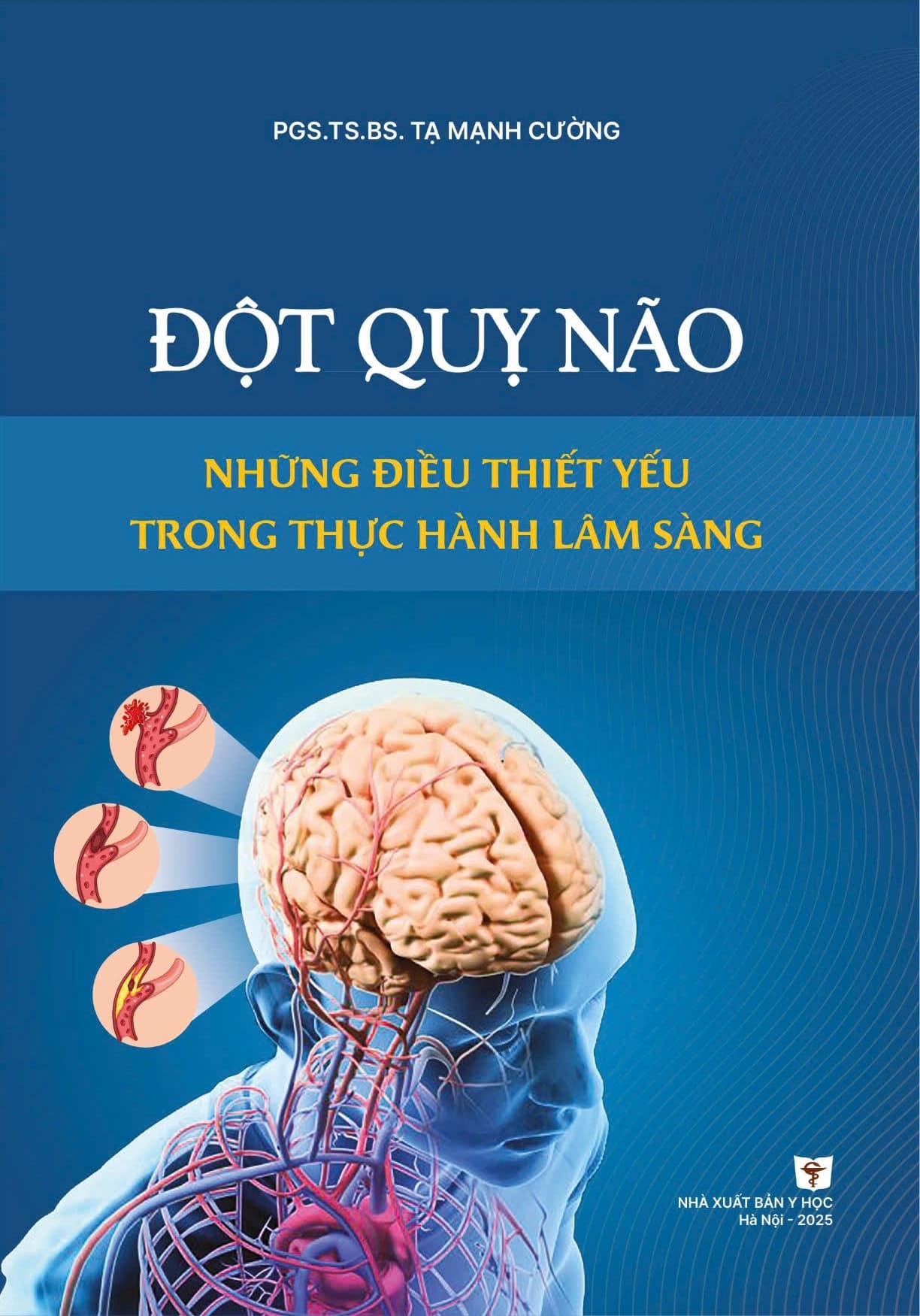 Đột Quỵ Não – Những Điều Thiết Yếu Trong Lâm Sàng PDF